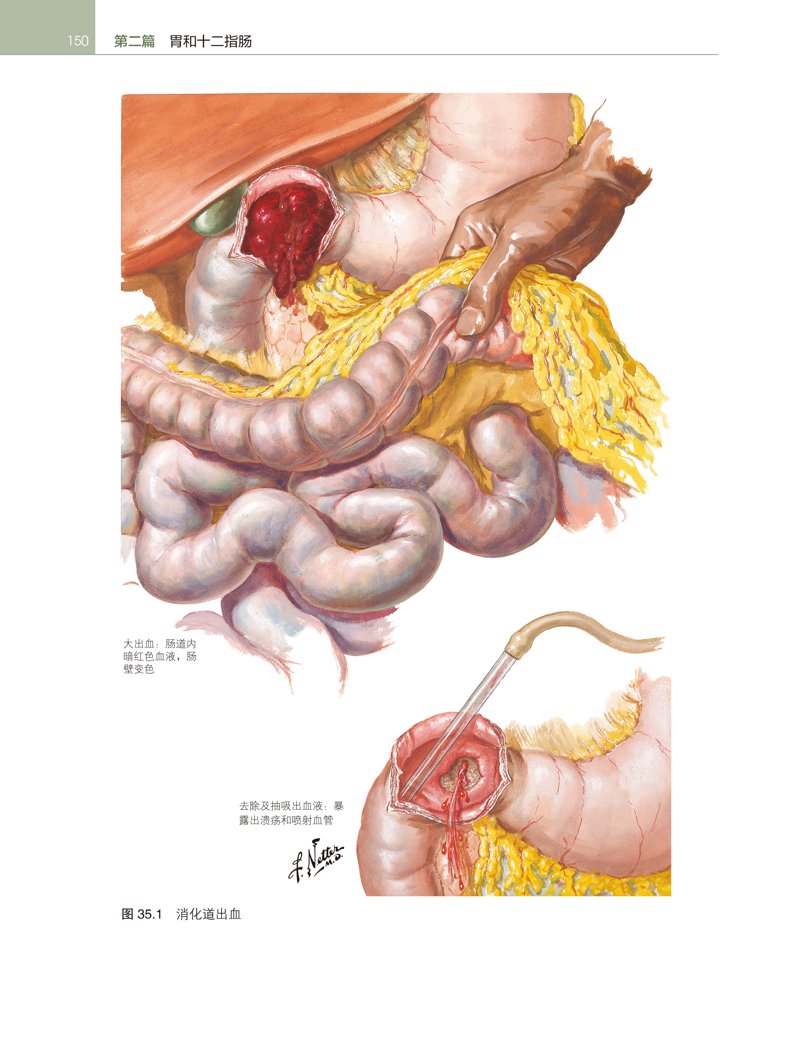 聚焦胃肠健康：北医胃肠病医院的最新发展