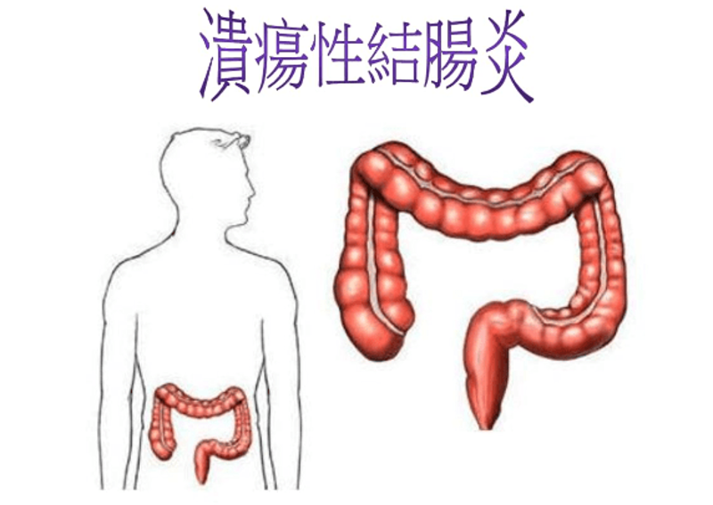 胃肠健康：北医胃肠病医院的最新进展