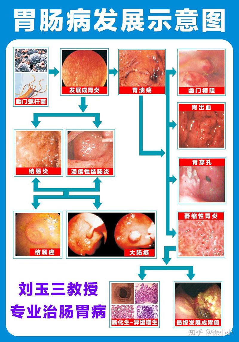 胃肠病治疗：现代医疗的温暖之光