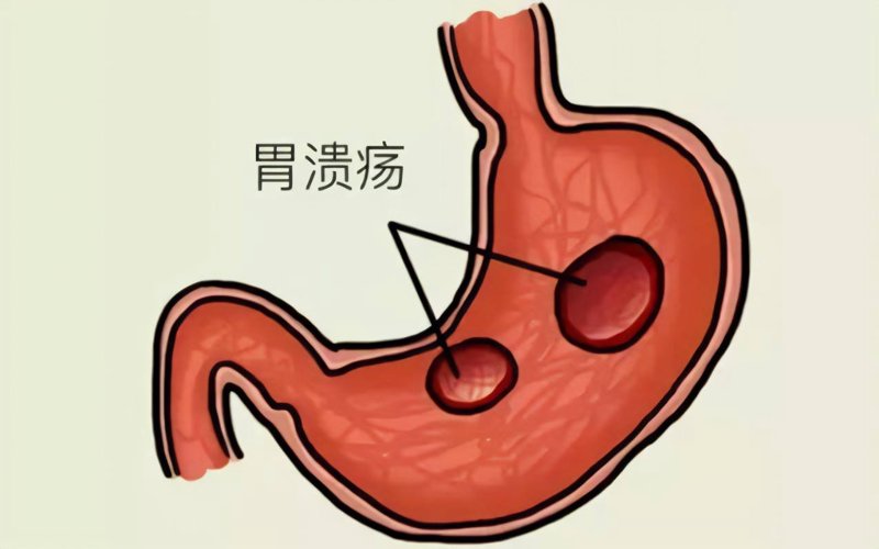 胃病医院：寻找心中的守护者